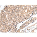 Immunohistochemistry - PRELID1 Antibody from Signalway Antibody (42978) - Antibodies.com