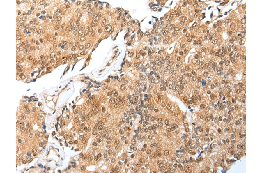 Immunohistochemistry - TRAPPC4 Antibody from Signalway Antibody (42979) - Antibodies.com