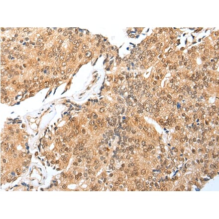 Immunohistochemistry - TRAPPC4 Antibody from Signalway Antibody (42979) - Antibodies.com