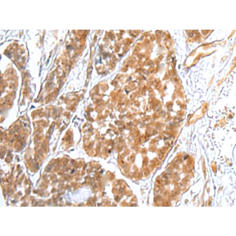 Immunohistochemistry - TRAPPC4 Antibody from Signalway Antibody (42979) - Antibodies.com