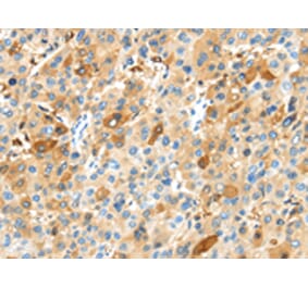 Immunohistochemistry - MAP3K10 Antibody from Signalway Antibody (43105) - Antibodies.com