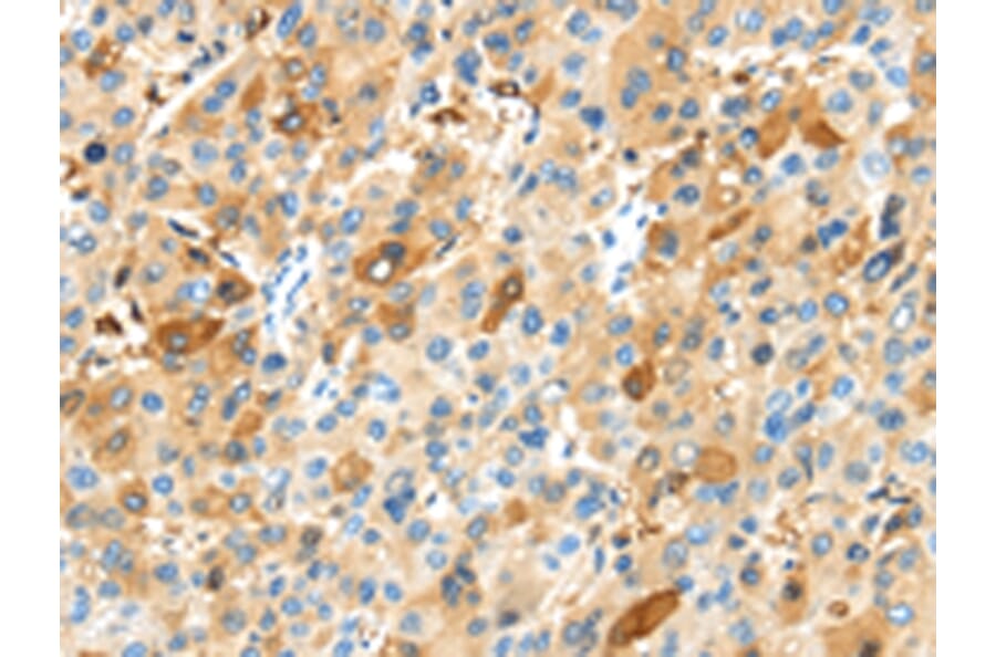 Immunohistochemistry - MAP3K10 Antibody from Signalway Antibody (43105) - Antibodies.com