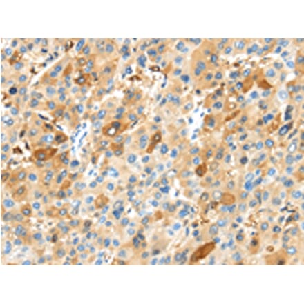 Immunohistochemistry - MAP3K10 Antibody from Signalway Antibody (43105) - Antibodies.com