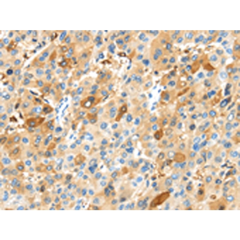 Immunohistochemistry - MAP3K10 Antibody from Signalway Antibody (43105) - Antibodies.com