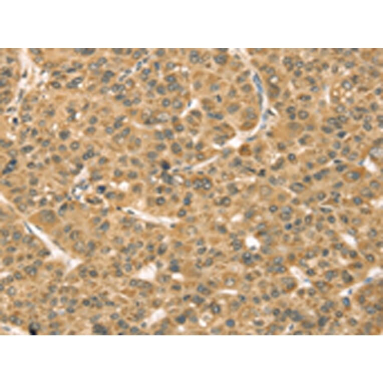 Immunohistochemistry - TMPRSS3 Antibody from Signalway Antibody (43162) - Antibodies.com