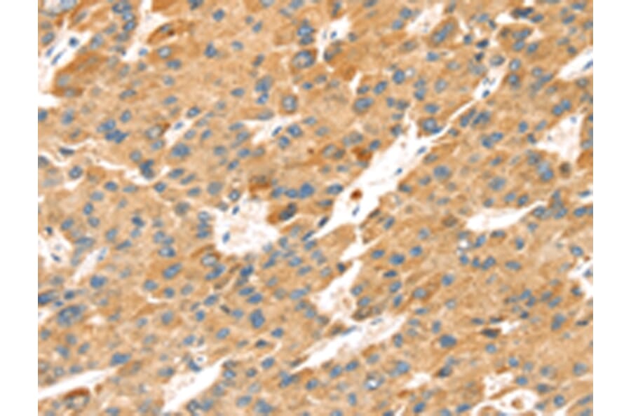 Immunohistochemistry - TNFSF15 Antibody from Signalway Antibody (43164) - Antibodies.com