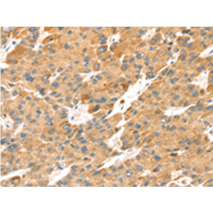Immunohistochemistry - TNFSF15 Antibody from Signalway Antibody (43164) - Antibodies.com