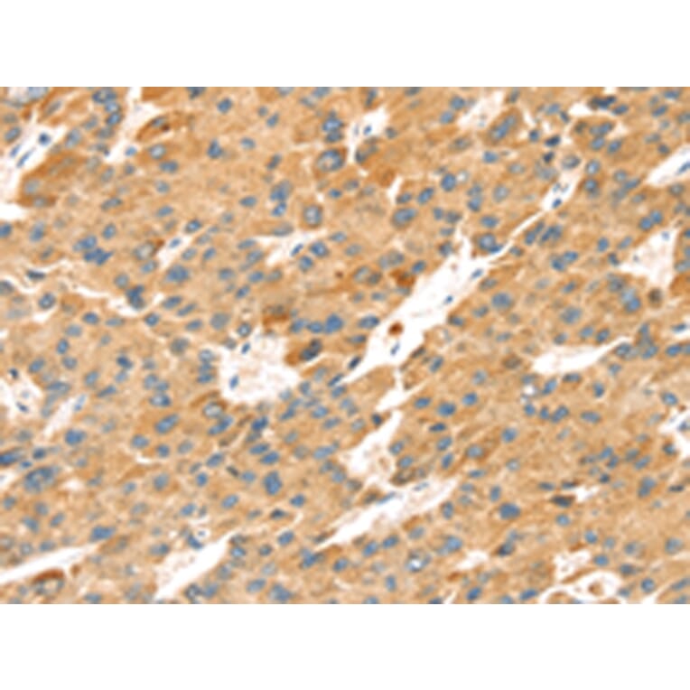 Immunohistochemistry - TNFSF15 Antibody from Signalway Antibody (43164) - Antibodies.com
