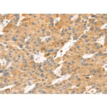 Immunohistochemistry - TNFSF15 Antibody from Signalway Antibody (43164) - Antibodies.com