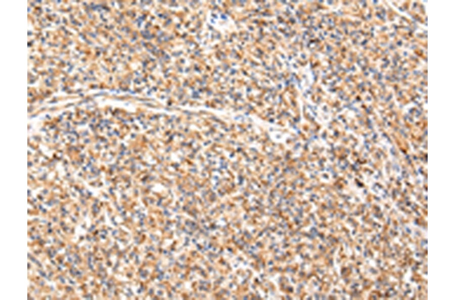 Immunohistochemistry - ADAMTS1 Antibody from Signalway Antibody (43224) - Antibodies.com