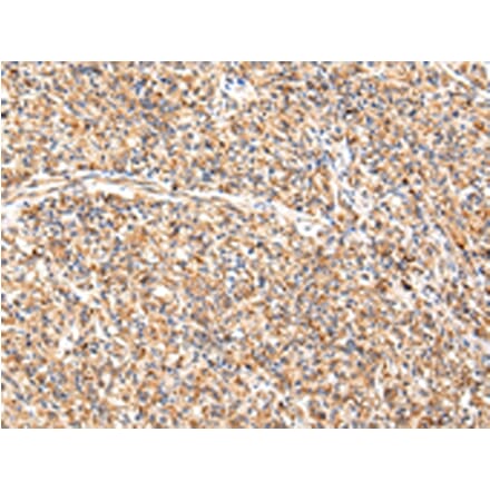 Immunohistochemistry - ADAMTS1 Antibody from Signalway Antibody (43224) - Antibodies.com