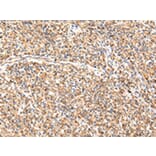 Immunohistochemistry - ADAMTS1 Antibody from Signalway Antibody (43224) - Antibodies.com