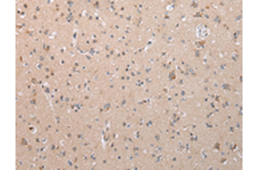 Immunohistochemistry - COL15A1 Antibody from Signalway Antibody (43264) - Antibodies.com