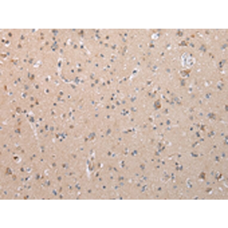 Immunohistochemistry - COL15A1 Antibody from Signalway Antibody (43264) - Antibodies.com