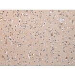 Immunohistochemistry - COL15A1 Antibody from Signalway Antibody (43264) - Antibodies.com
