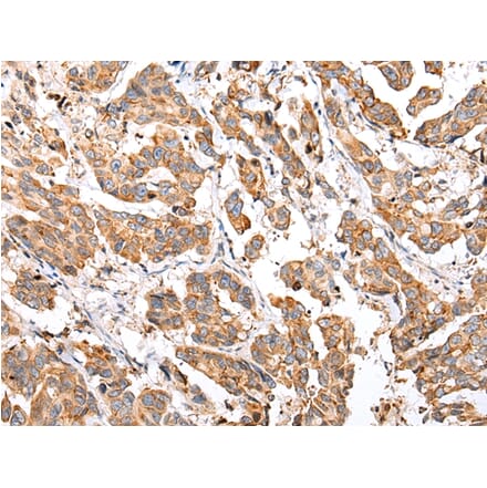 Immunohistochemistry - COX7A2L Antibody from Signalway Antibody (43279) - Antibodies.com