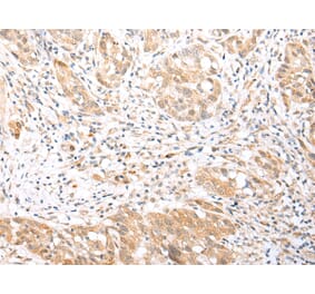 Immunohistochemistry - BCL2L11 Antibody from Signalway Antibody (43283) - Antibodies.com