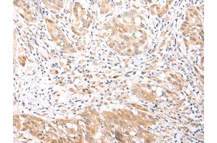 Immunohistochemistry - BCL2L11 Antibody from Signalway Antibody (43283) - Antibodies.com