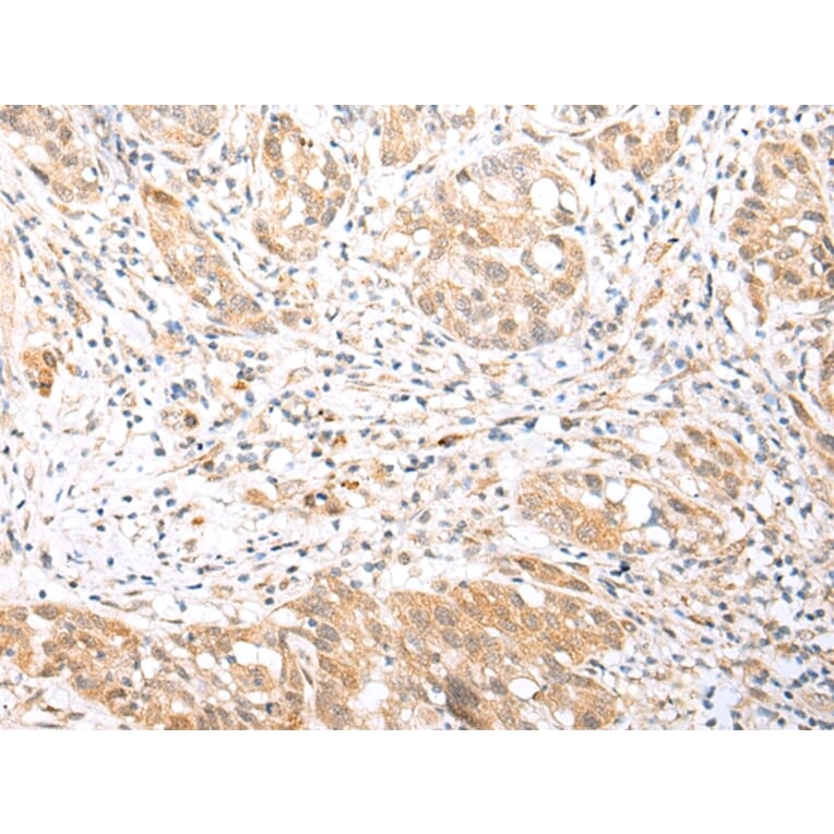 Immunohistochemistry - BCL2L11 Antibody from Signalway Antibody (43283) - Antibodies.com