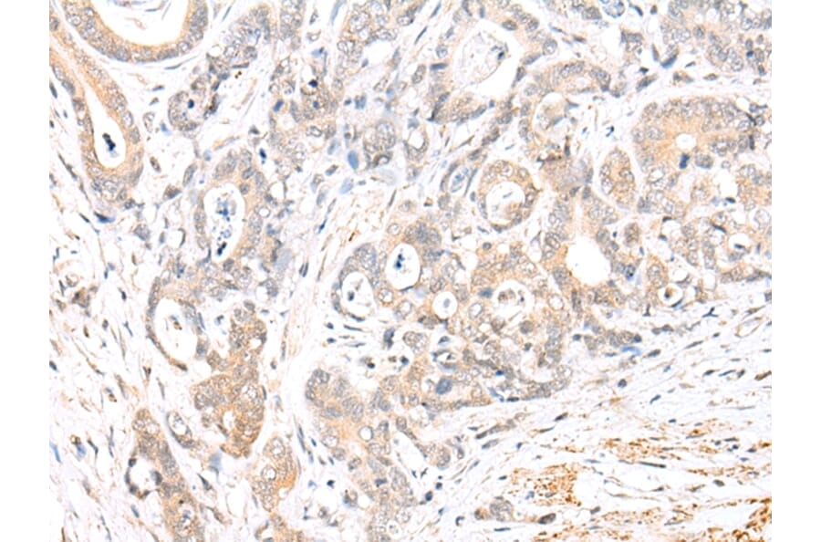 Immunohistochemistry - BCL2L11 Antibody from Signalway Antibody (43283) - Antibodies.com