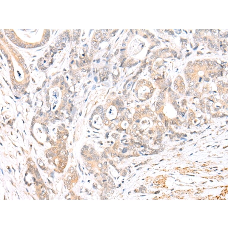 Immunohistochemistry - BCL2L11 Antibody from Signalway Antibody (43283) - Antibodies.com
