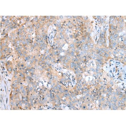 Immunohistochemistry - SDCCAG8 Antibody from Signalway Antibody (43294) - Antibodies.com