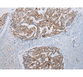 Immunohistochemistry - ADAMTS3 Antibody from Signalway Antibody (43307) - Antibodies.com