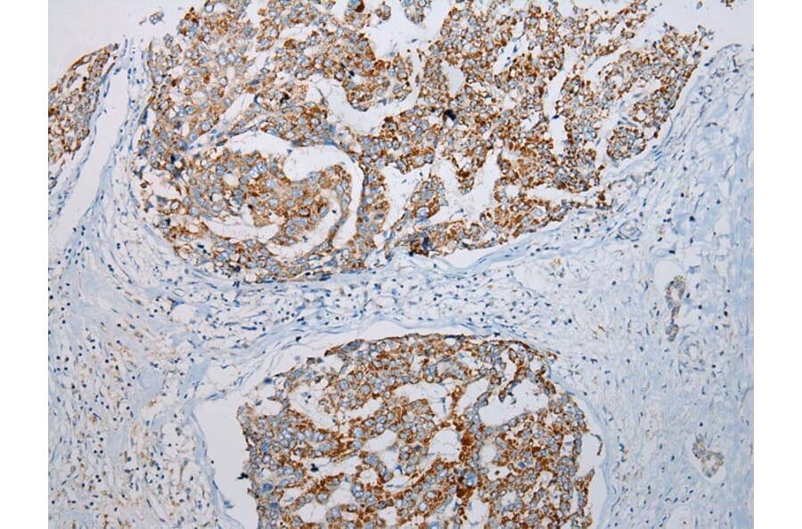 Immunohistochemistry - ADAMTS3 Antibody from Signalway Antibody (43307) - Antibodies.com