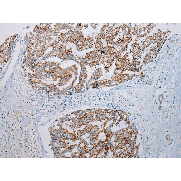 Immunohistochemistry - ADAMTS3 Antibody from Signalway Antibody (43307) - Antibodies.com