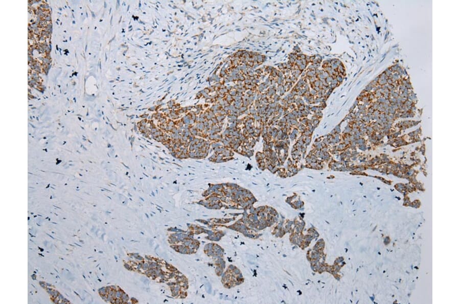 Immunohistochemistry - ADAMTS3 Antibody from Signalway Antibody (43307) - Antibodies.com