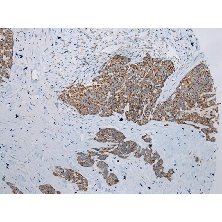 Immunohistochemistry - ADAMTS3 Antibody from Signalway Antibody (43307) - Antibodies.com