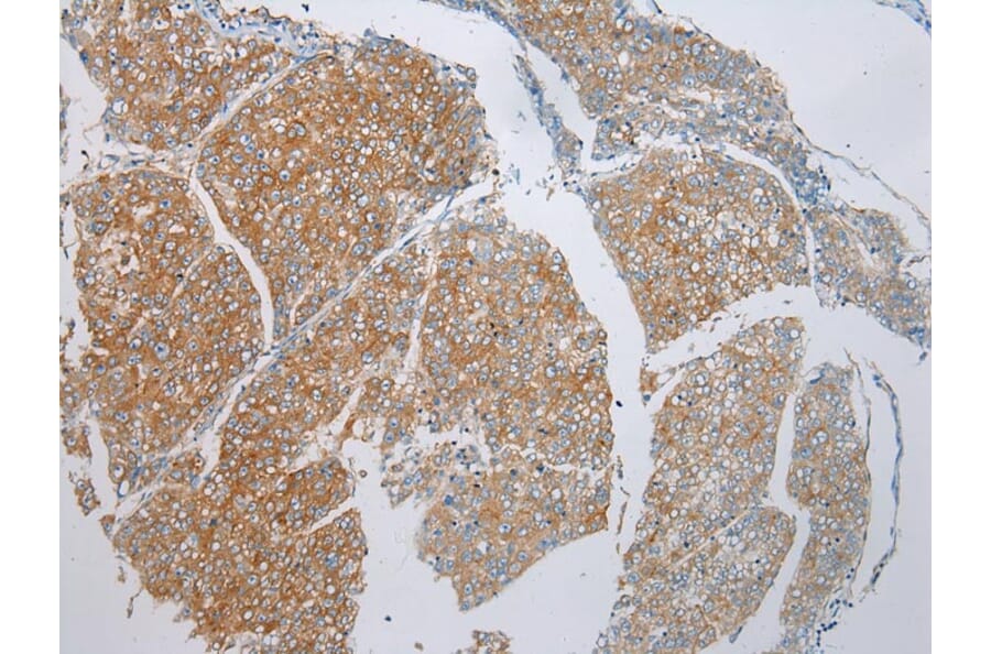 Immunohistochemistry - ADAMTS9 Antibody from Signalway Antibody (43308) - Antibodies.com