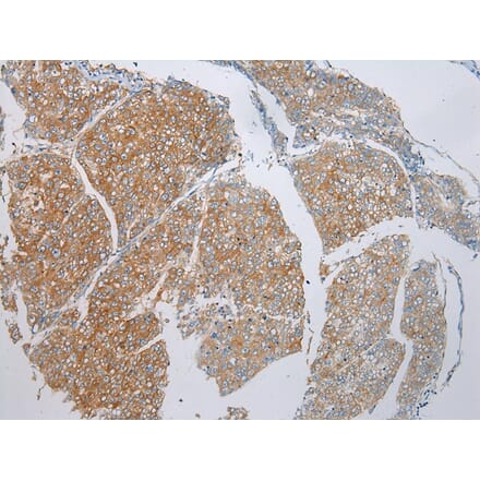 Immunohistochemistry - ADAMTS9 Antibody from Signalway Antibody (43308) - Antibodies.com