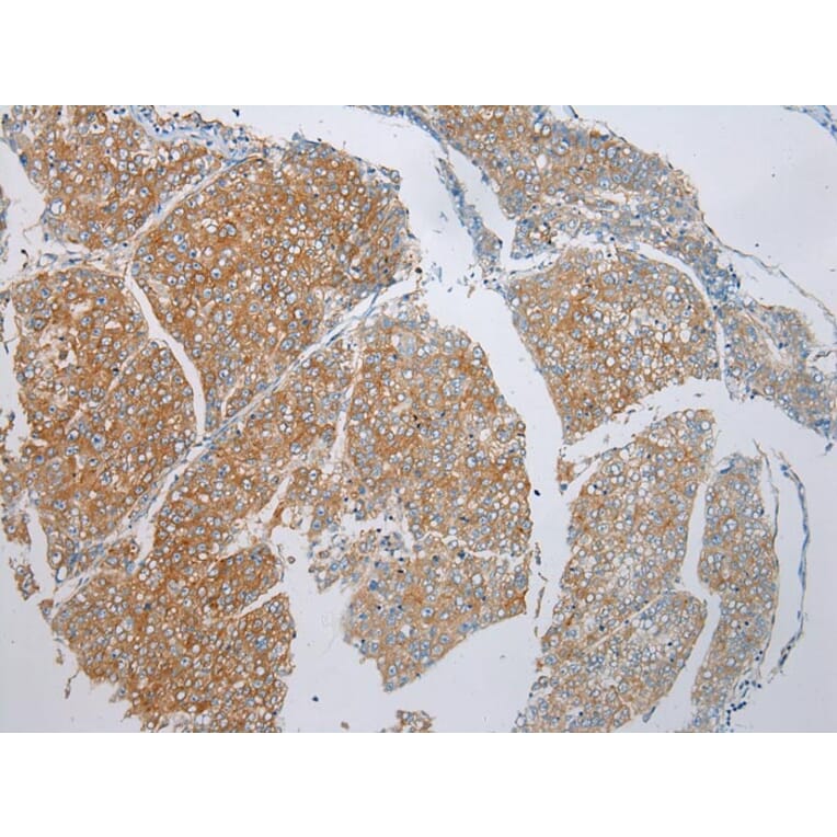Immunohistochemistry - ADAMTS9 Antibody from Signalway Antibody (43308) - Antibodies.com