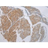 Immunohistochemistry - ADAMTS9 Antibody from Signalway Antibody (43308) - Antibodies.com