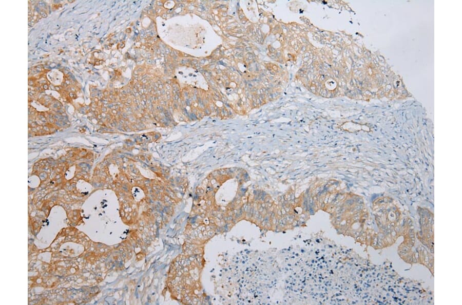 Immunohistochemistry - ADAMTS9 Antibody from Signalway Antibody (43308) - Antibodies.com