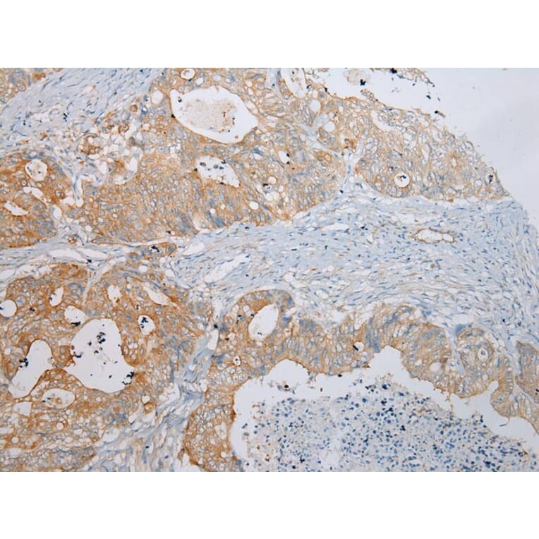 Immunohistochemistry - ADAMTS9 Antibody from Signalway Antibody (43308) - Antibodies.com