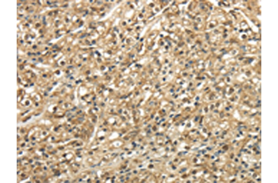 Immunohistochemistry - TSC22D1 Antibody from Signalway Antibody (43344) - Antibodies.com