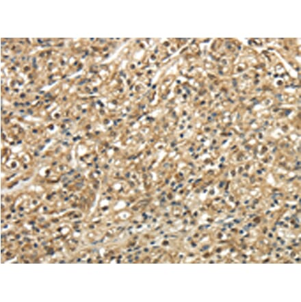 Immunohistochemistry - TSC22D1 Antibody from Signalway Antibody (43344) - Antibodies.com