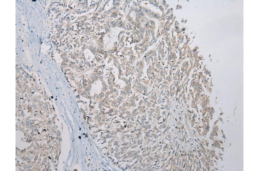 Immunohistochemistry - SLC35E2 Antibody from Signalway Antibody (43365) - Antibodies.com