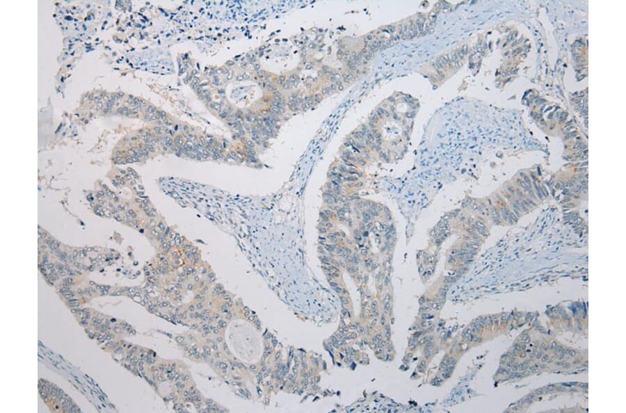 Immunohistochemistry - SLC35E2 Antibody from Signalway Antibody (43365) - Antibodies.com