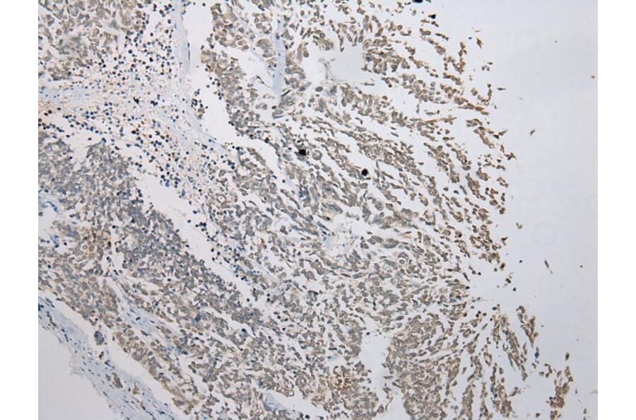 Immunohistochemistry - FAM101A Antibody from Signalway Antibody (43371) - Antibodies.com