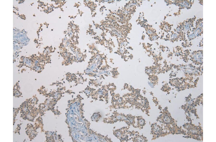 Immunohistochemistry - FAM101A Antibody from Signalway Antibody (43371) - Antibodies.com