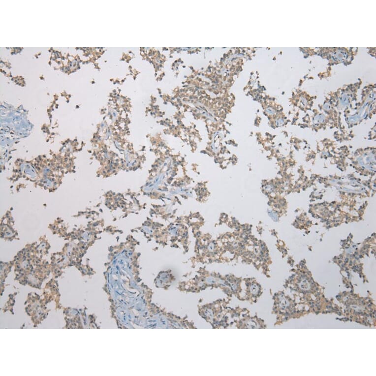 Immunohistochemistry - FAM101A Antibody from Signalway Antibody (43371) - Antibodies.com