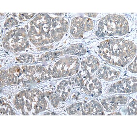 Immunohistochemistry - COMMD10 Antibody from Signalway Antibody (43383) - Antibodies.com