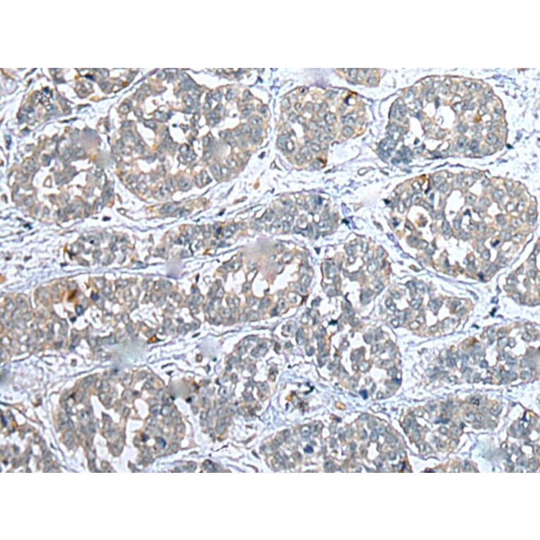 Immunohistochemistry - COMMD10 Antibody from Signalway Antibody (43383) - Antibodies.com