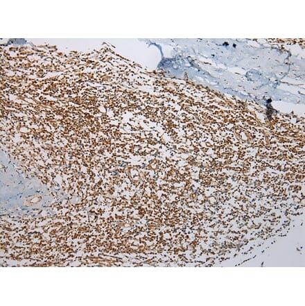 Immunohistochemistry - ABHD14B Antibody from Signalway Antibody (43384) - Antibodies.com