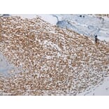 Immunohistochemistry - ABHD14B Antibody from Signalway Antibody (43384) - Antibodies.com