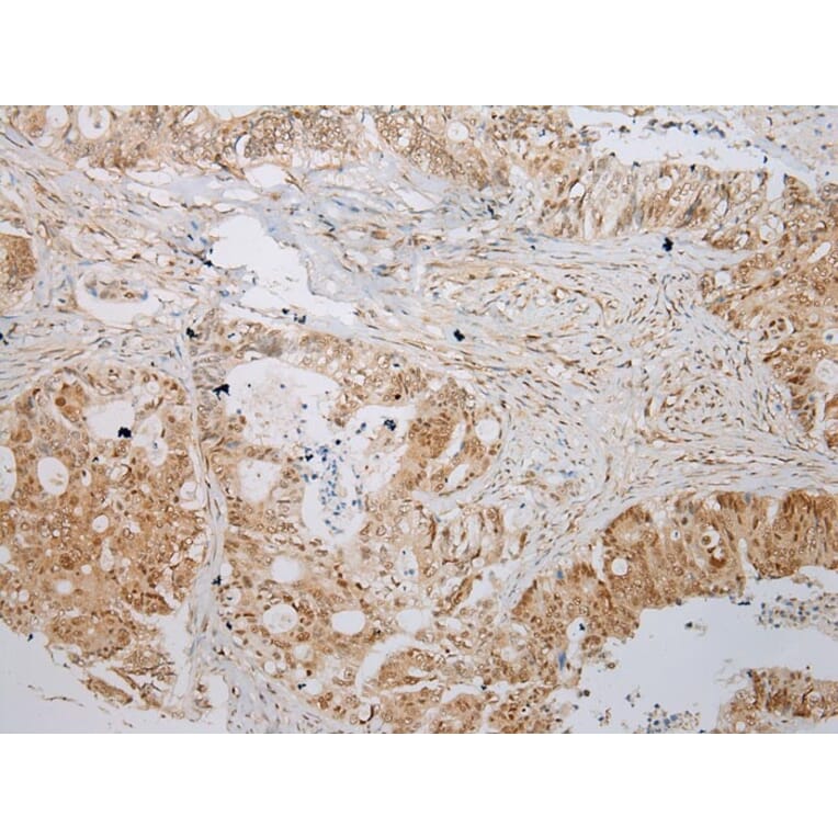 Immunohistochemistry - ABHD14B Antibody from Signalway Antibody (43384) - Antibodies.com