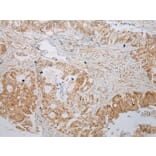 Immunohistochemistry - ABHD14B Antibody from Signalway Antibody (43384) - Antibodies.com
